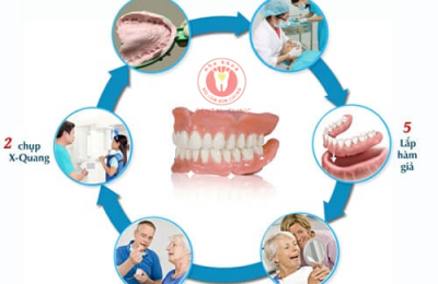 PHỤC HÌNH RĂNG BẰNG HÀM THÁO LẮP AN TOÀN VÀ TIẾT KIỆM CHI PHÍ
