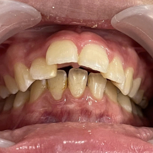 Tên: Chị Hạnh (Mẹ bé Tường Vy, 13 tuổi)